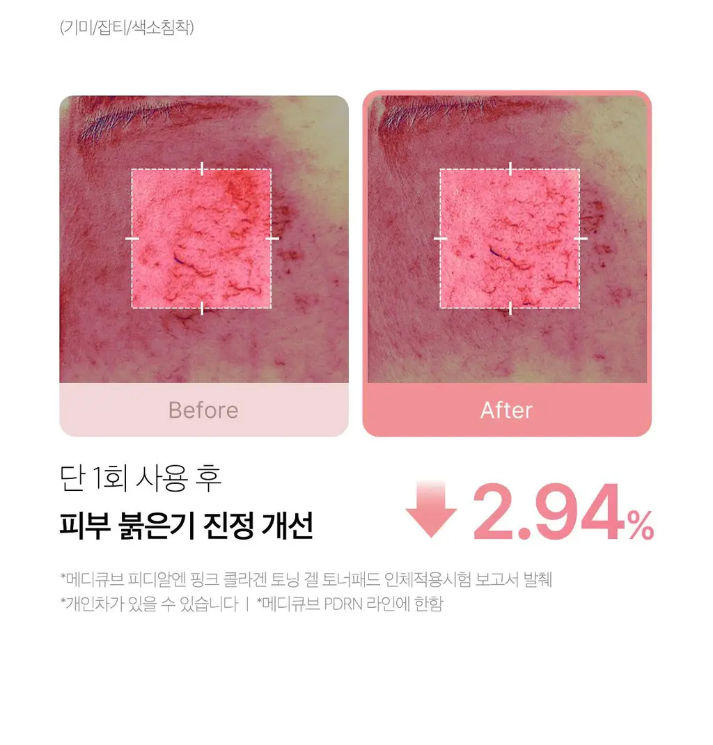 [쿨링광채]메디큐브 PDRN 핑크 콜라겐 토닝 겔 토너패드 70매 기획(본품70매+겔패드10매) 상세페이지 18